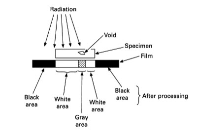 x-ray(rt)